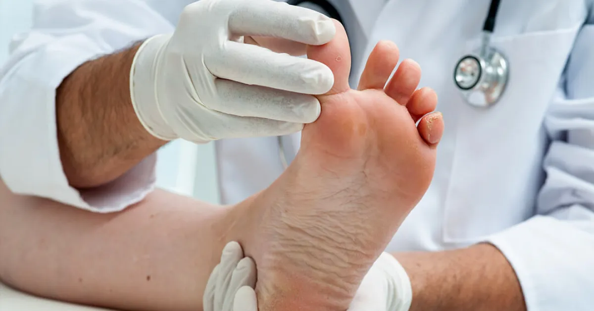 Foot Care for Diabetes